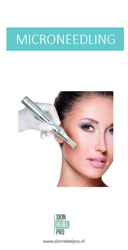 Consumentenflyers Microneedling (20 stuks)