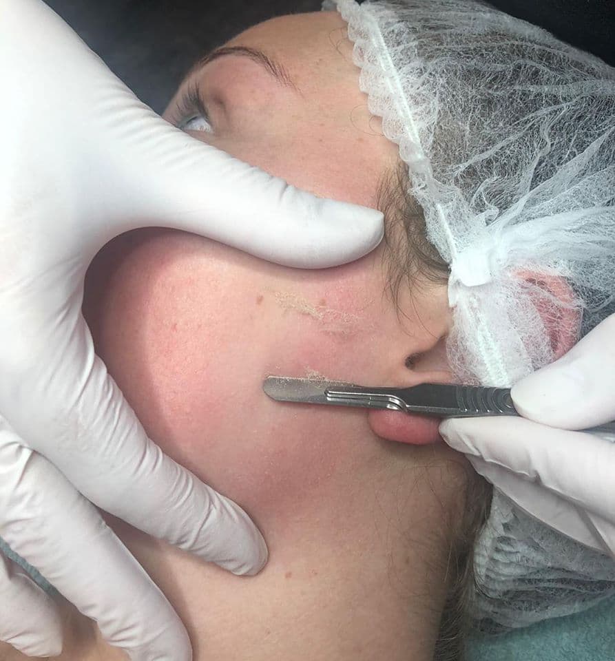Training DermaPlaning (zonder startpakket)